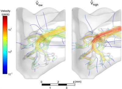 Cell Inertia: Predicting Cell Distributions in Lung Vasculature to Optimize Re-endothelialization